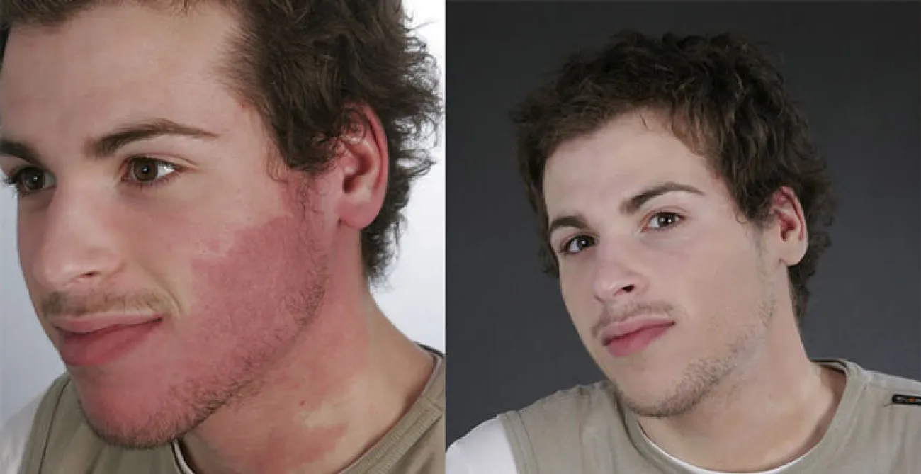 Maquillage correctif et de réparation